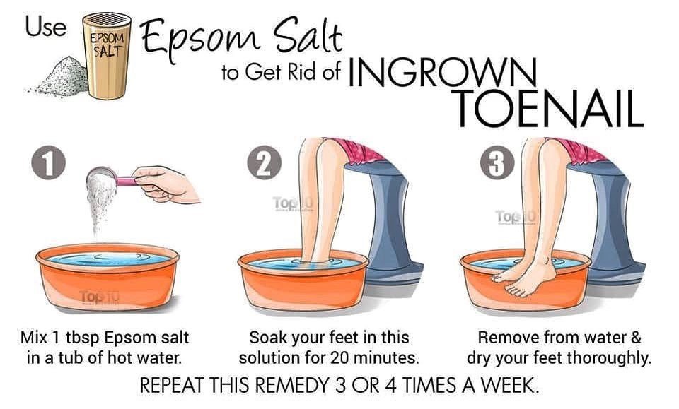 1Kg Epsom Salt Natural Mineral Fertilizer / Beauty Health - Image 4